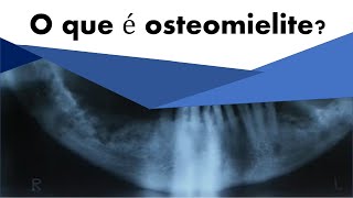 O que é osteomielite  Odontologia  Dra Bianca Rosa [upl. by Anaehs86]