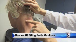 Beware of biting gnats outdoors [upl. by Attennaj]