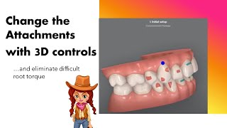 Invisalign ClinCheck  Changing attachments with 3D controls [upl. by Christine]