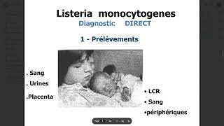 Bacteriologie  Bacteries a transmission MereEnfant FMPC [upl. by Esteban]