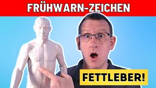 10 Frühwarnzeichen dass Du eine Fettleber hast [upl. by Kent331]