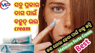 Melacare Forte Cream For Melasma Benefits And Sideeffects Review In Odia [upl. by Beyer858]