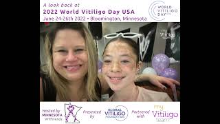 World Vitiligo Day USA 2022 [upl. by Ccasi]