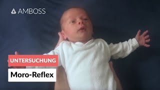 MoroReflex  Frühkindliche Reflexe  AMBOSS Video [upl. by Felty867]