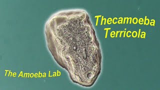 Amoeba  Thecamoeba Terricola by The AmoebaLab [upl. by Enneiluj]