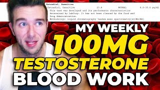 My Blood Work On 100 MG Testosterone Per Week With Accurate LCMSMS [upl. by Erasmo273]