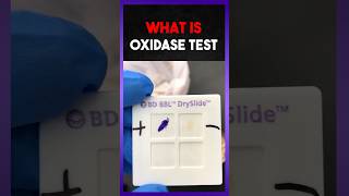 Oxidase Test  Clear Explain [upl. by Theo]