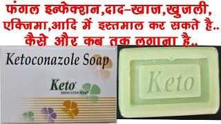 Keto Soap UsesBenefits Side Effects  Ketoconazole 2 ww Soap🔥🔥 [upl. by Elleniad641]