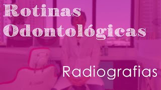 Radiografias  Rotinas Odontológicas [upl. by Rior303]