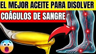 DERRITE LOS COÁGULOS DE SANGRE DE FORMA NATURAL LOS 6 ACEITES MÁS PODEROSOS [upl. by Tommie]