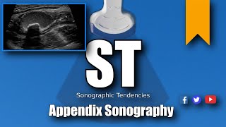 Appendix Ultrasound [upl. by Saba]