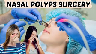 Nasal Polyps Treatment  Nasal Surgery  Nasal Polyps ENT Lecture [upl. by Hsu]