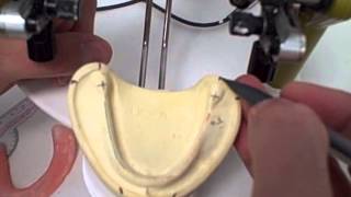 1 Setting the Occlusal Plane [upl. by Rekcut]