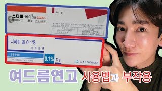 Eng sub여드름연고사용법과부작용 How to use acne ointment and what the side effects are สิว [upl. by Nisior]