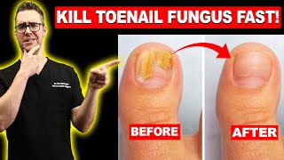 1 BEST Toenail Fungus Treatment Top 10 Home Remedies 2024 [upl. by Elumas]