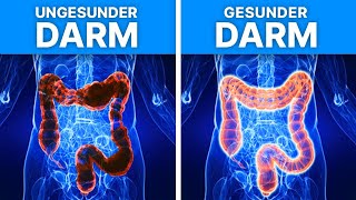 5 Lebensmittel die du essen solltest um deinen Darm zu reinigen [upl. by Kcyred600]