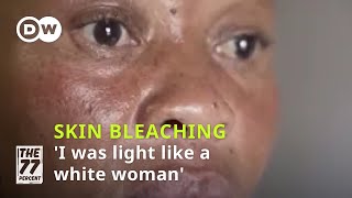 Skin bleaching The risks behind the beauty craze│DW The 77 Percent [upl. by Kavita]