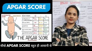 APGAR scoring in detail pediatrics apgar neonatalicu newbornbaby [upl. by Rovaert]