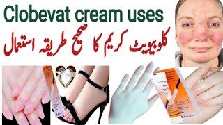 clobevate cream for hands and feet whitening  clobevate for skin whiteing  clobetasol  eczema [upl. by Sesmar]