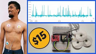 IoT based Lowcost ECG amp Heart monitoring system with ESP32 and Ubidots Platform [upl. by Neuberger94]