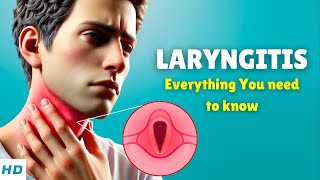 Laryngitis Losing Your Voice – Causes Signs and Symptoms Diagnosis amp Treatment [upl. by Thaddeus]