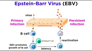 Mononucleosis EpsteinBarr Virus [upl. by Alex]