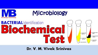 BIOCHEMICAL TEST  Bacterial Identification Technique  Microbiology  Vivek Srinivas Bacteriology [upl. by Ilram912]