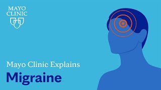 Mayo Clinic Explains Migraine [upl. by Hanas]