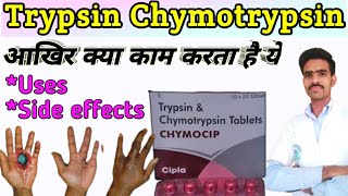 trypsin chymotrypsin tablet uses in hindi  trypsin bromelain rutoside trihydrate tablets  Trypsin [upl. by Schenck455]