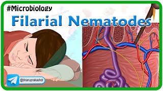 Filarial nematodes Animation🐛 Wuchereria onchocera volvulus LoaLoa Dracunculus Trichinella [upl. by Chilson]