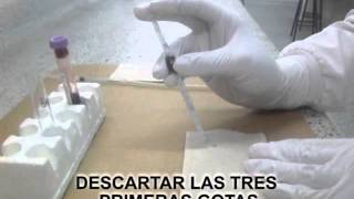 RECUENTO DE PLAQUETAS FLV 1 [upl. by Ahsini]