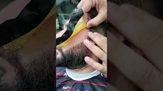 ازاله شعر الادقن بالشمع 😂✂️💈 fun funny funnyvideo foryou comedy viralvideo fyp [upl. by Seto]