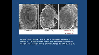 Surgery in the Care of Medullary Thyroid Cancer [upl. by Paza]