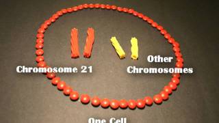 Nondisjunction Trisomy 21  An Animated Tutorial [upl. by Ahtnicaj]