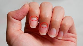 The Moons on Your Nails Reveal This About Your Health [upl. by Yerffeg]