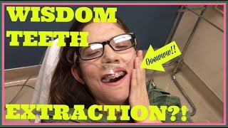 WISDOM TEETH EXTRACTION ROAD TO RECOVERY  28 MONTHS UPDATE [upl. by Quick]