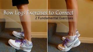 Exercises To Correct Bowed Legs  How to Fix Bowed Legs [upl. by Enaid]