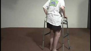 Abnormal Gait Exam  Neuropathic Gait [upl. by Neibaf]