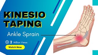 How to treat an Ankle Inversion Sprain  Kinesiology Taping to stabilise ligaments [upl. by Henryk829]