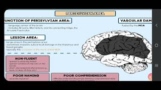 Global Aphasia An overview [upl. by Ormand]