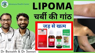 Homeopathic medicine for lipoma charbi ki ganth ka ilaj  lipoma homeopathic medicine [upl. by Anirtac]