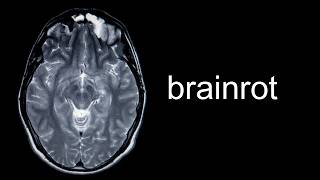 watch this video to cure brainrot [upl. by Delorenzo]