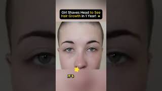 Girl Shaves Head to See Hair Growth in 1 Year 🌟 [upl. by Elyse107]