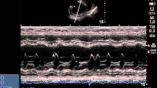 Cardiomiopatía dilatada caninaCanine dilated cardiomiopathy [upl. by Amla934]