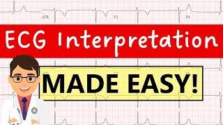 How to interpret an ECG systematically  EXPLAINED CLEARLY [upl. by Oijimer]