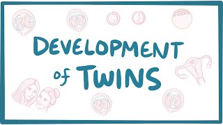 Development of twins [upl. by Allene]