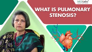 Dr Smita Mishra  What is pulmonary stenosis [upl. by Isiad]