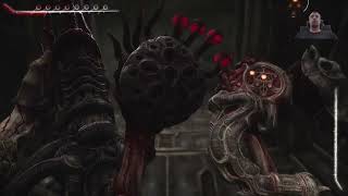 Scorn gameplay part 2 Scorn [upl. by Elwaine]