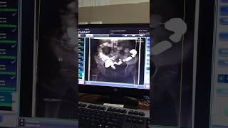 X ray  fluoroscopy procedure  fluoroscopy trending viral shorts arabic [upl. by Silyhp64]