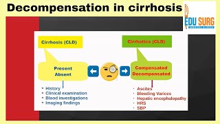 Cirrhosis stages  decompensated cirrhosis  cirrhosis of liver  small talk series [upl. by Nitsrik3]